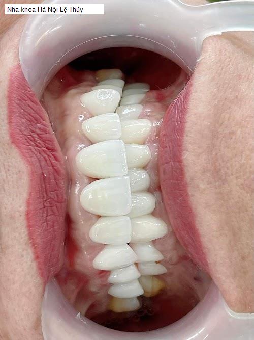 Yến Sào Quảng Bình - Gợi ý 4 Nha Khoa tốt nhất khu vực Huyện Lệ Thủy